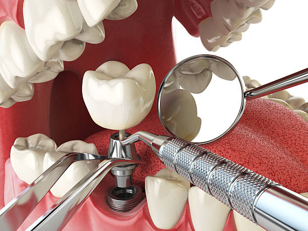 Best Emergency Treatment for Dental Infections or Abscesses in Sea Breeze, NC